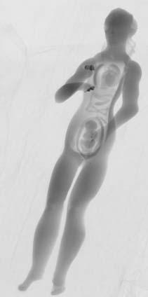 Imaging Uncovers Secrets of Medicine's Mysterious Ivory Manikins