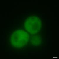 Yeast Cells with GFP and Non-amyloid Prion protein