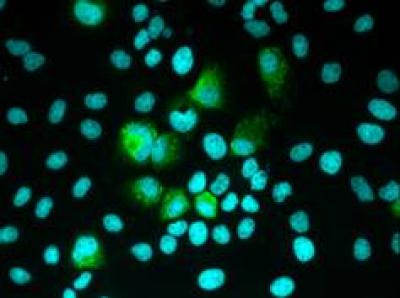 Infected Human Cells with MiceCD81