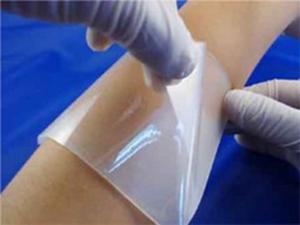 Incheon National University scientists develop new hydrogels for wound management