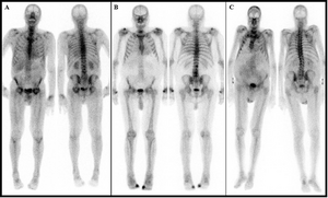 Images of patient examples considered as low-grade uptake.