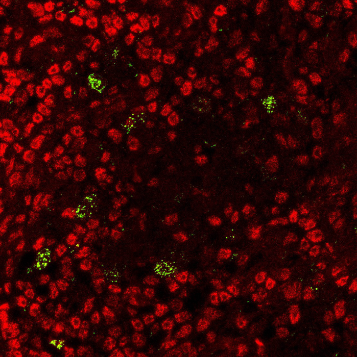 Thymus cells making AIRE (green) that educate the surrounding developing T cells (red).