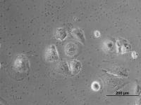 Cells Treated with miR-429