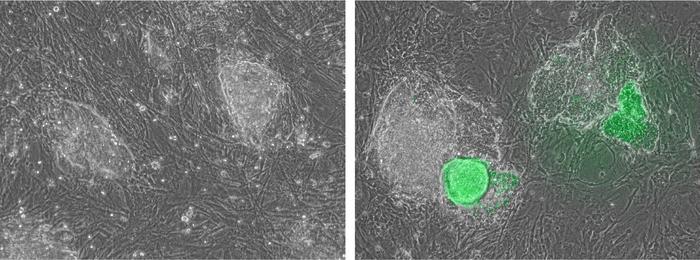 Before and after interferon gamma treatment