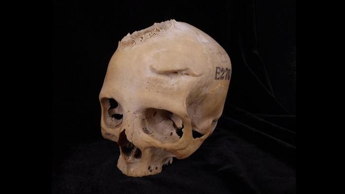 Skull E270