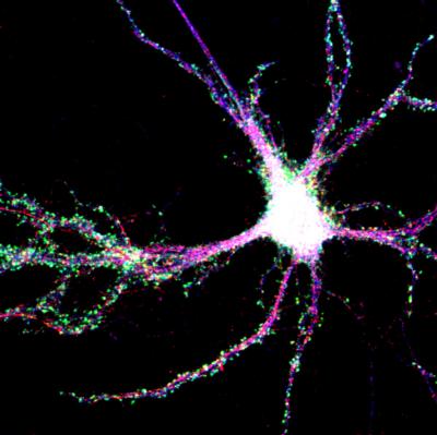 SUMO in a Brain Cell