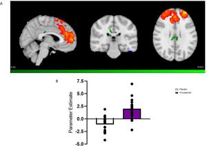 Serotonin booster leads to increased functional brain connectivity