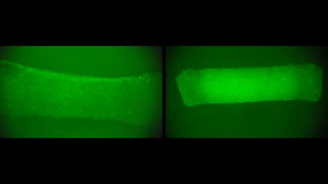 Improved Muscle Contraction in 3D Construct with Stem Cell Combination