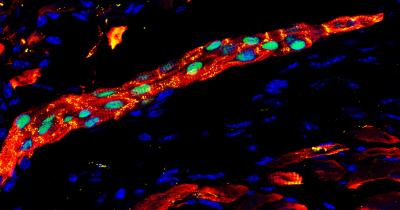 Human Heart Precursor Cells Self-Organised Into Human Muscle Fiber In Damaged Mouse Heart