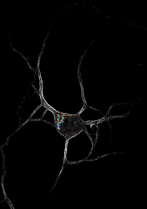 Receptor Location Matters for Psychedelic Drug Effects