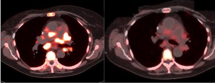 Side-by-Side Molecular Imaging