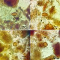 Parasite eggs found in fecal samples from Ripley/Choate House privy under magnification.