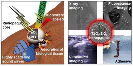 Nanoparticles Made with a Shell of Silica (SiO2) and a Core of Radiopaque Tantalum Oxide (TaOx)