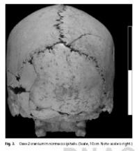 Oase 2 Cranium in Norma Occipitalis
