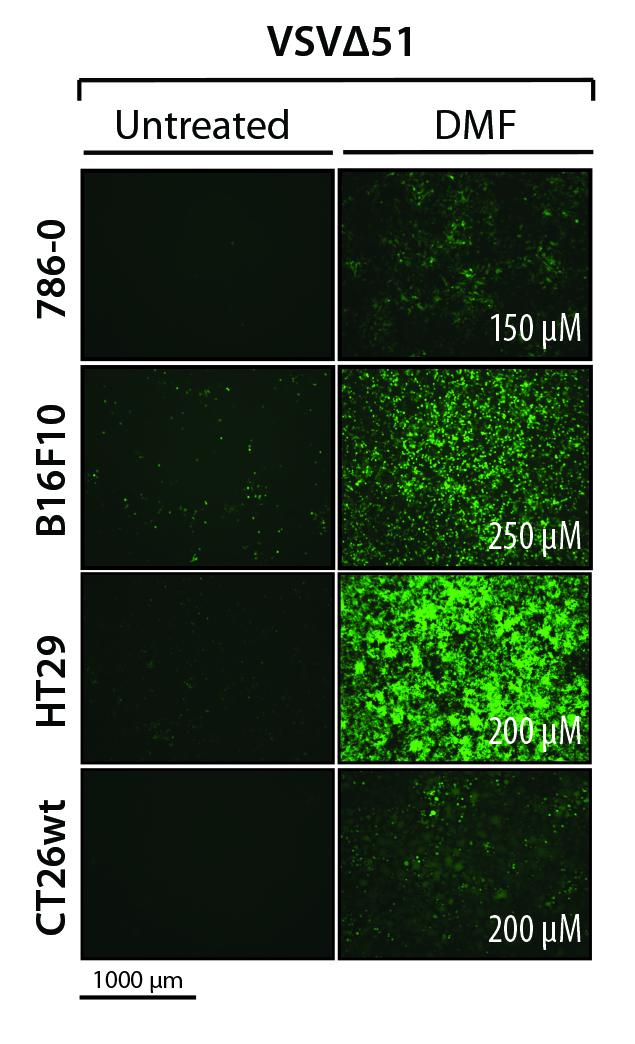 Cancer-Killing Viruses Get Boost from a Common Autoimmune Disease Therapy (2 of 2)