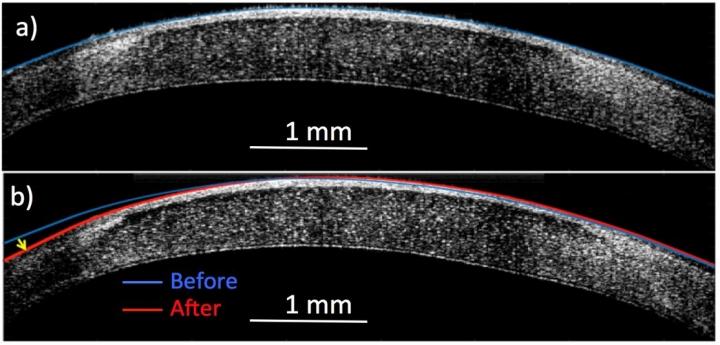 'Molecular Surgery' Reshapes Living Tissue with Electricity but No Incisions