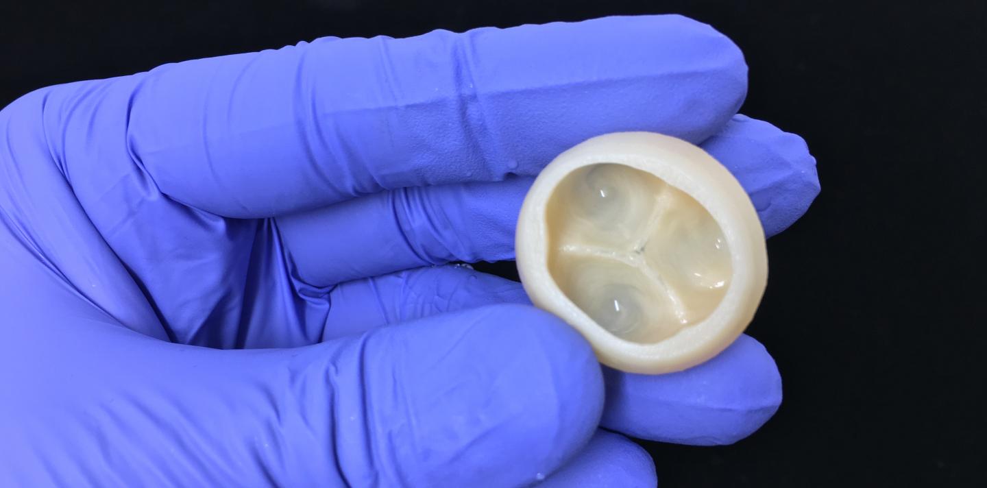 Trileaflet Heart Valve FRESH Printed Using Collagen