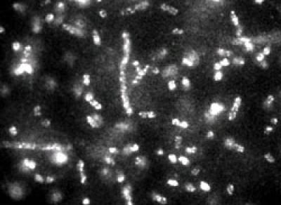 Fluorescence Micrograph of Phage-quantum Dot Complexes Bound to E. coli Cells