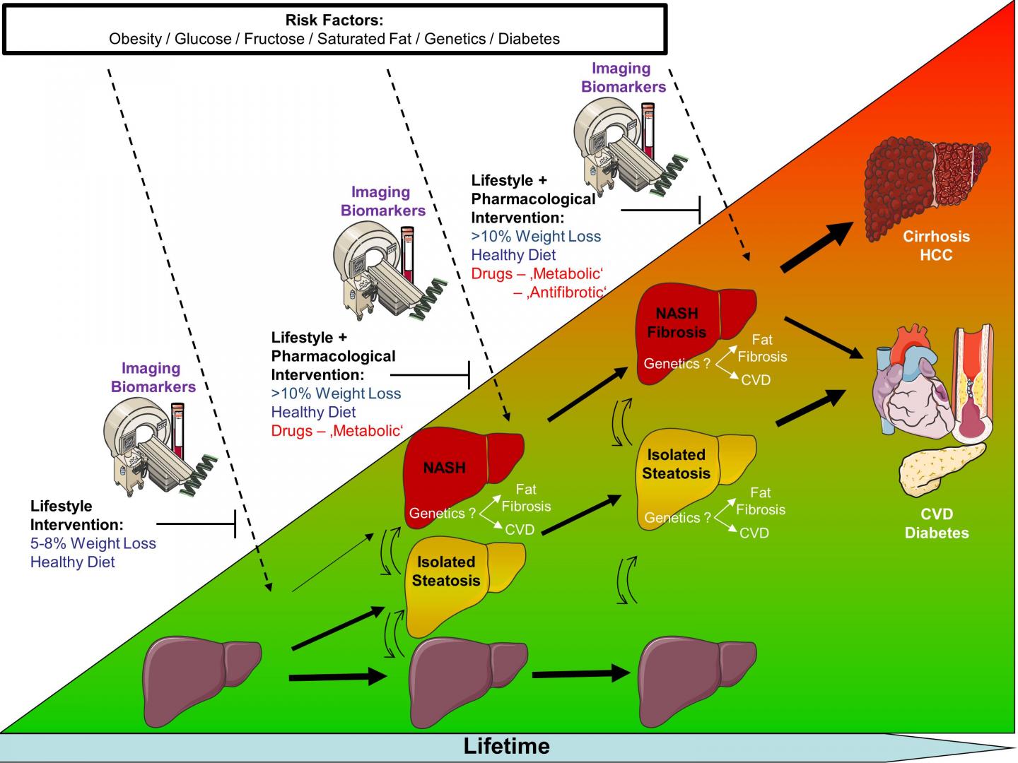 Risk of Liver and Cardiometabolic Diseases, and Treatment Approaches