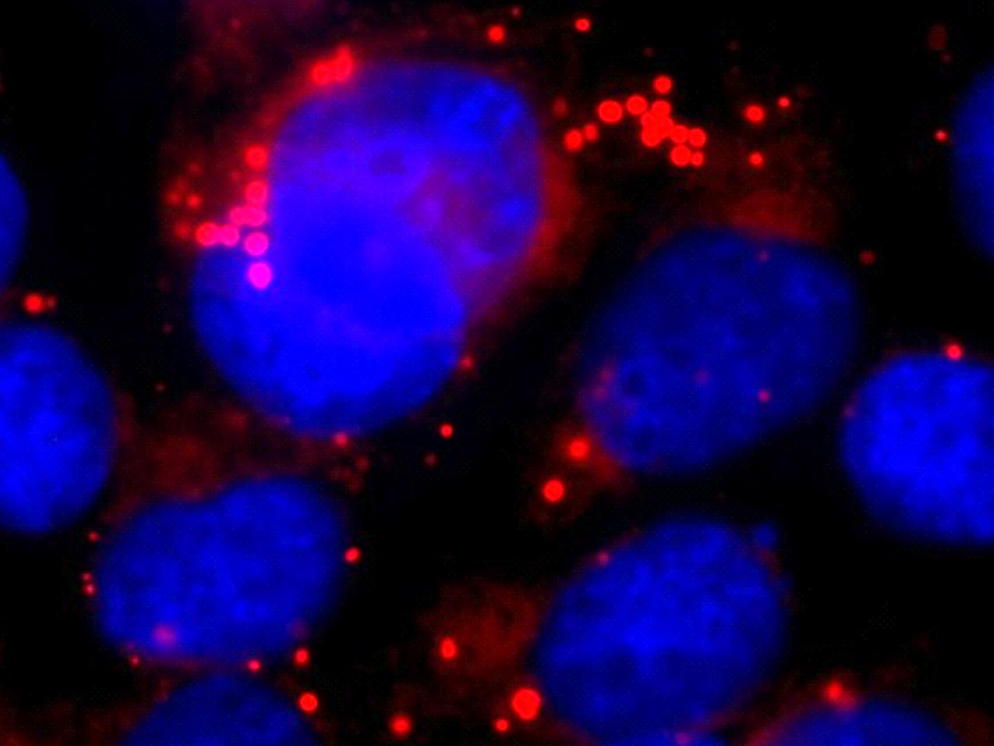 After Inhibition of Secretase