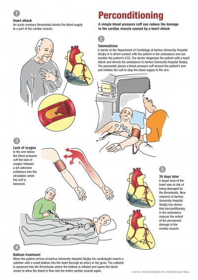 Does your blood pressure go up when you have a store heart attack