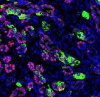 Functioning Human Pancreatic Cells