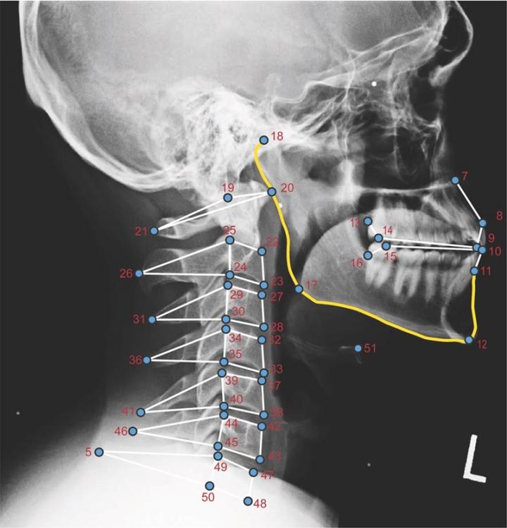 X-ray