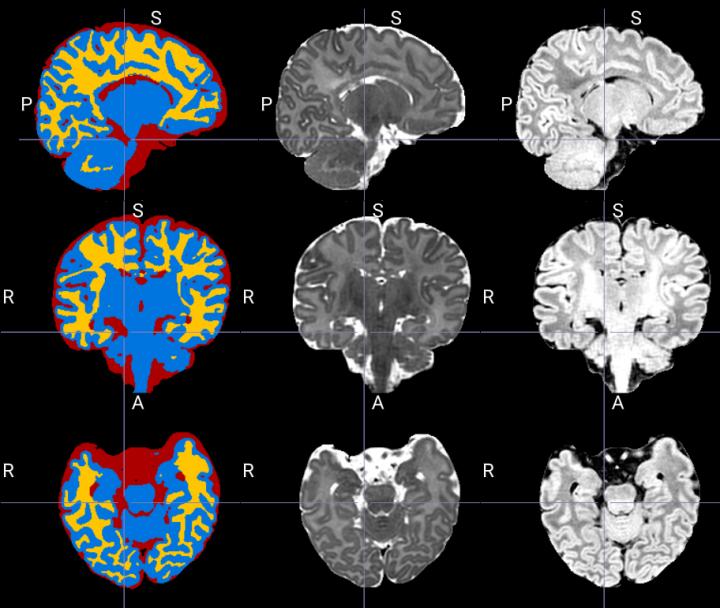 Example of Segmentation