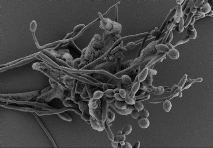 Neutrophils Interacting with a Fungal Biofilm in an Anoxic Environment