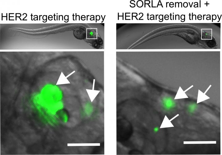 HER2 targeting therapy and SORLA