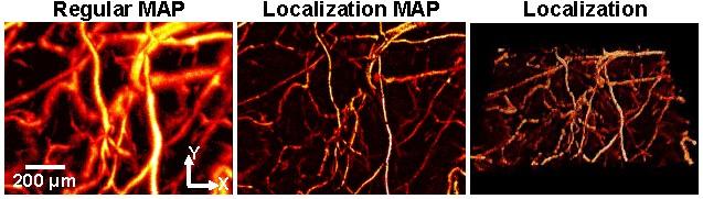 Photoacoustic Image of Microvessels in a Mouse Ear