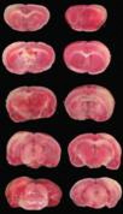 Acupuncture at Neiguan