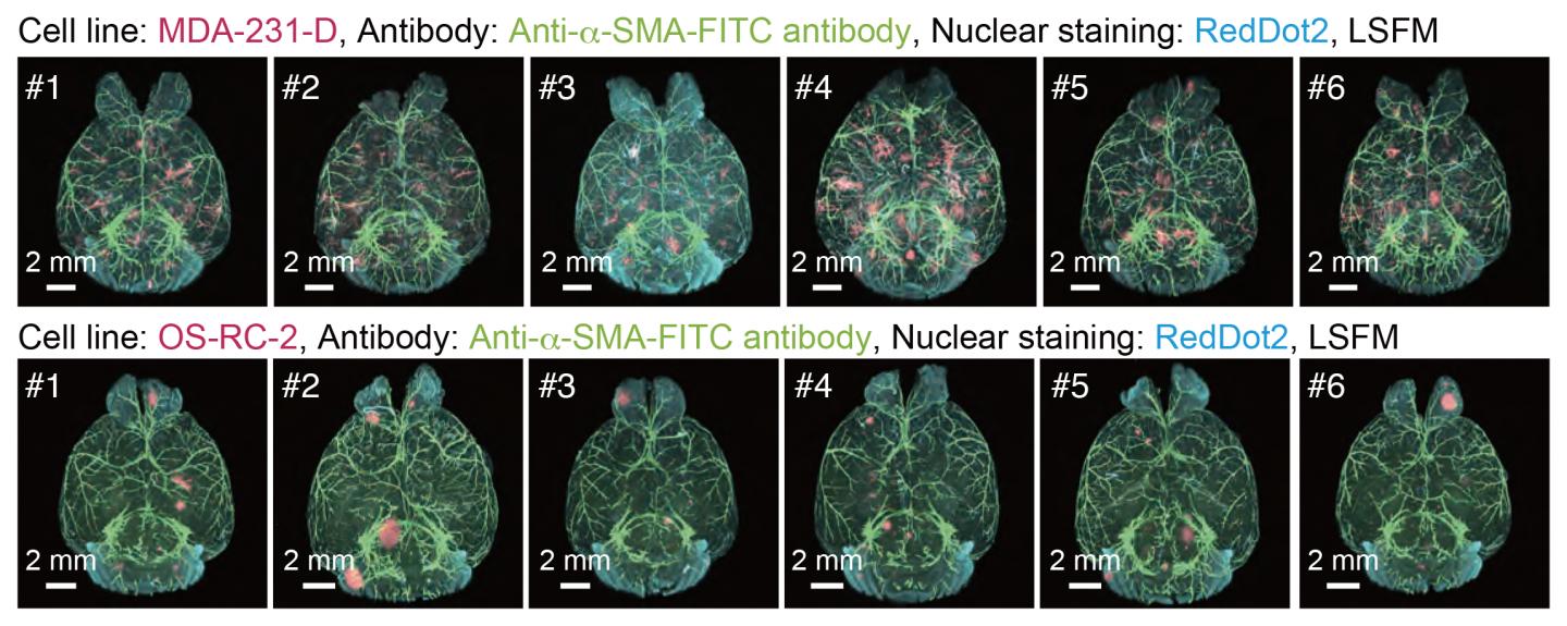 3-D Analysis of the Metastatic Patterns in Experimental Brain Metastasis Models