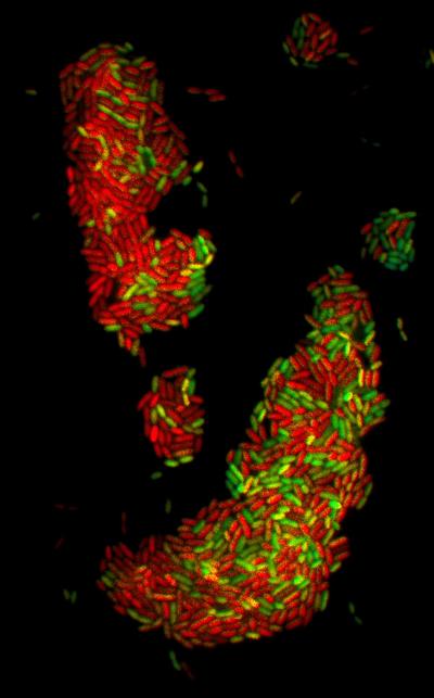Biosensor in Bacteria