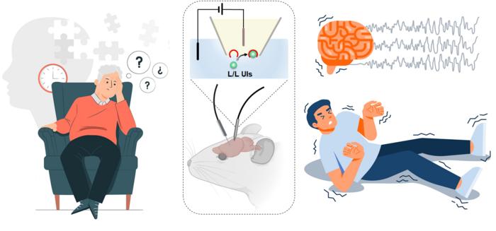 Liquid/liquid interfacial ultramicro iontronics for in vivo dynamic tracking of cerebral chloride regulation in AD and Pakinson diseases