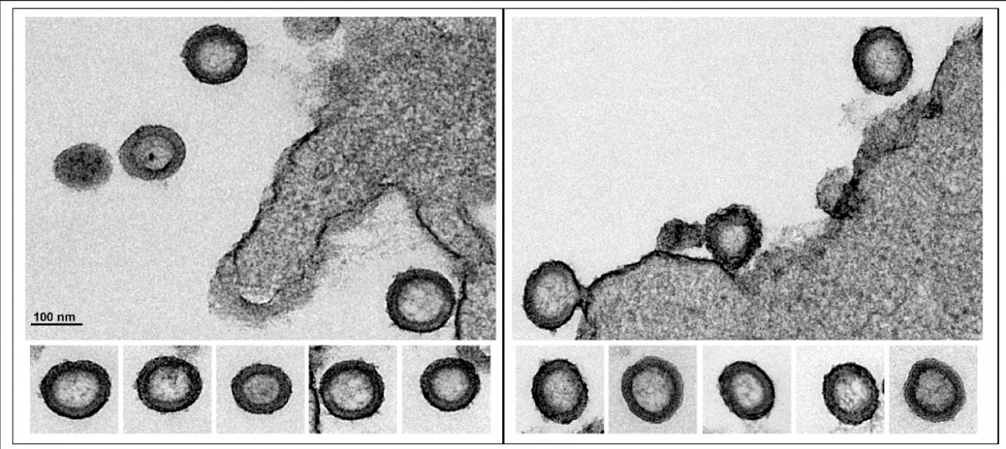 Virus-Like Particles