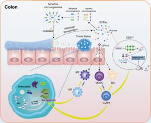 Fig. 1. Colon tumor suppression mechanism of Oxa@HMI Gel via regulating microbiota and immune microenvironment.