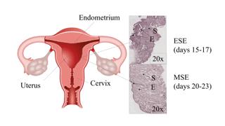 Figure The Proporations of Epithelian and Stromal Cells Vary in Endometrial Tissue