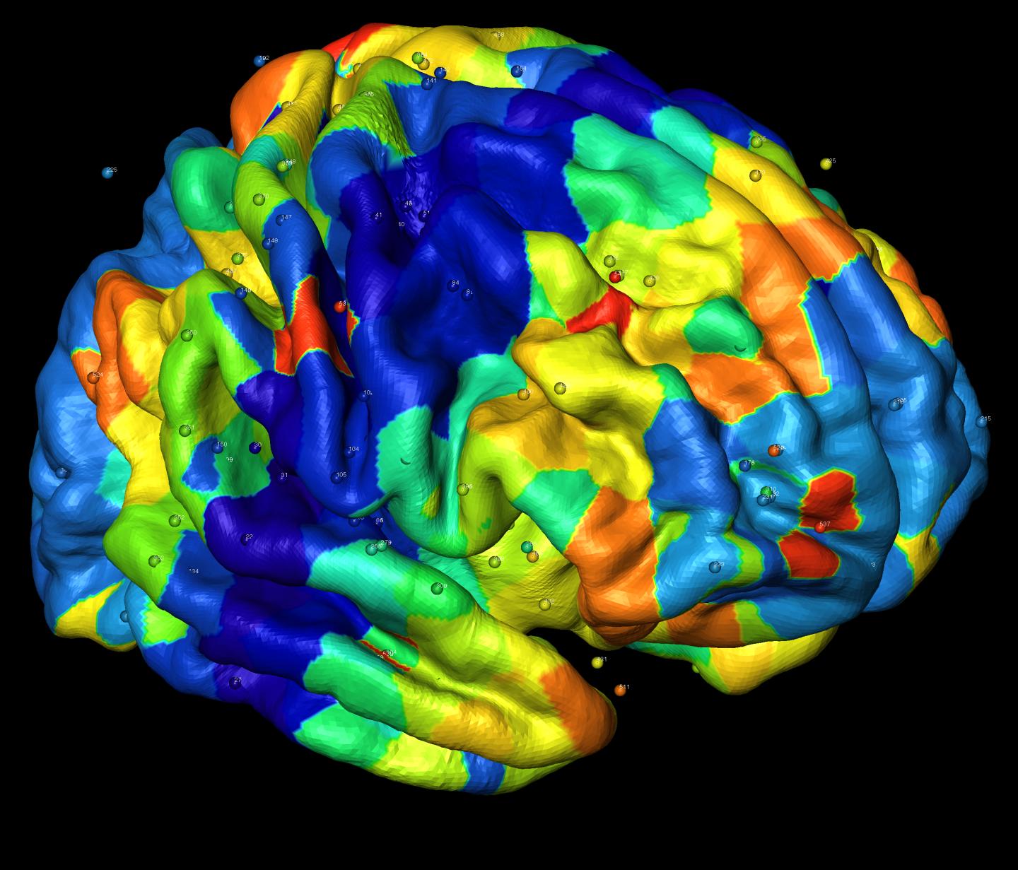 Genetic Factors are Responsible for Creating Anatomical Patterns in the Brain Cortex