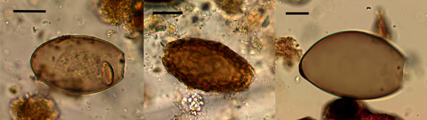 Eggs of Parasites Found in Ancient Faeces at the Must Farm Excavation