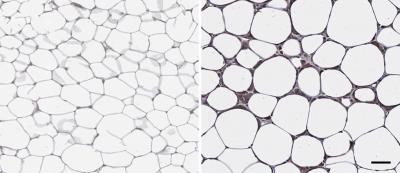 Neutrophil Elastase in Fat Tissue