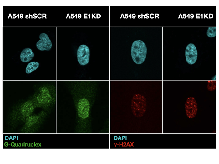 Localization of G-Quadruplexes and Histones in the Presence and Absence of hnRNP E1