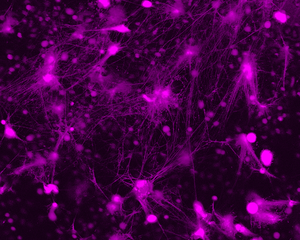 Neutrophil Enhancer Traps (NETs)