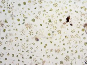 Leven algae under low magnification