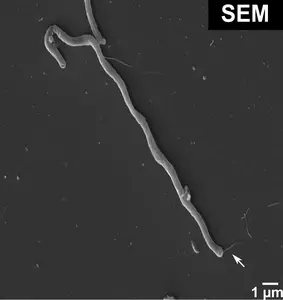 SEM 1: Electron microscopy of Taurinivorans muris in pure culture