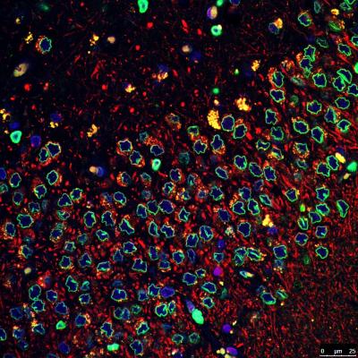 Salk Scientists Pinpoint Key Player in Parkinson's Disease Neuron Loss (1 of 2)