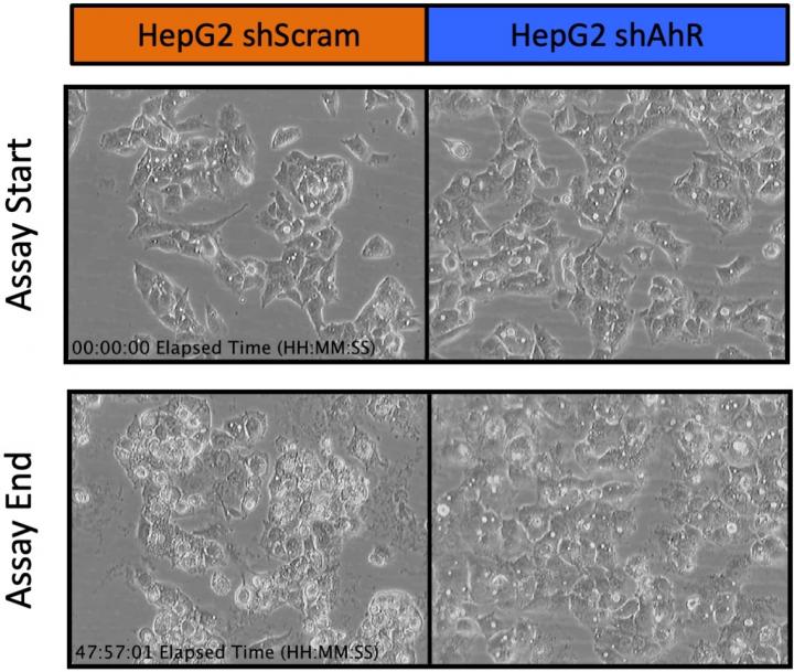 cancer treatment cells