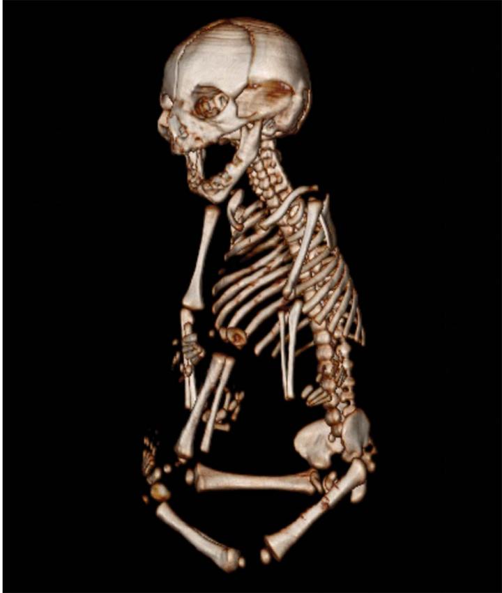 Fetal Image Reconstruction