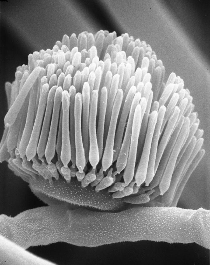 Image of the Early-Diverging Fungus, Linderina Pennispora