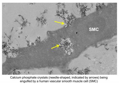 Human Vascular Smooth Muscle Cell